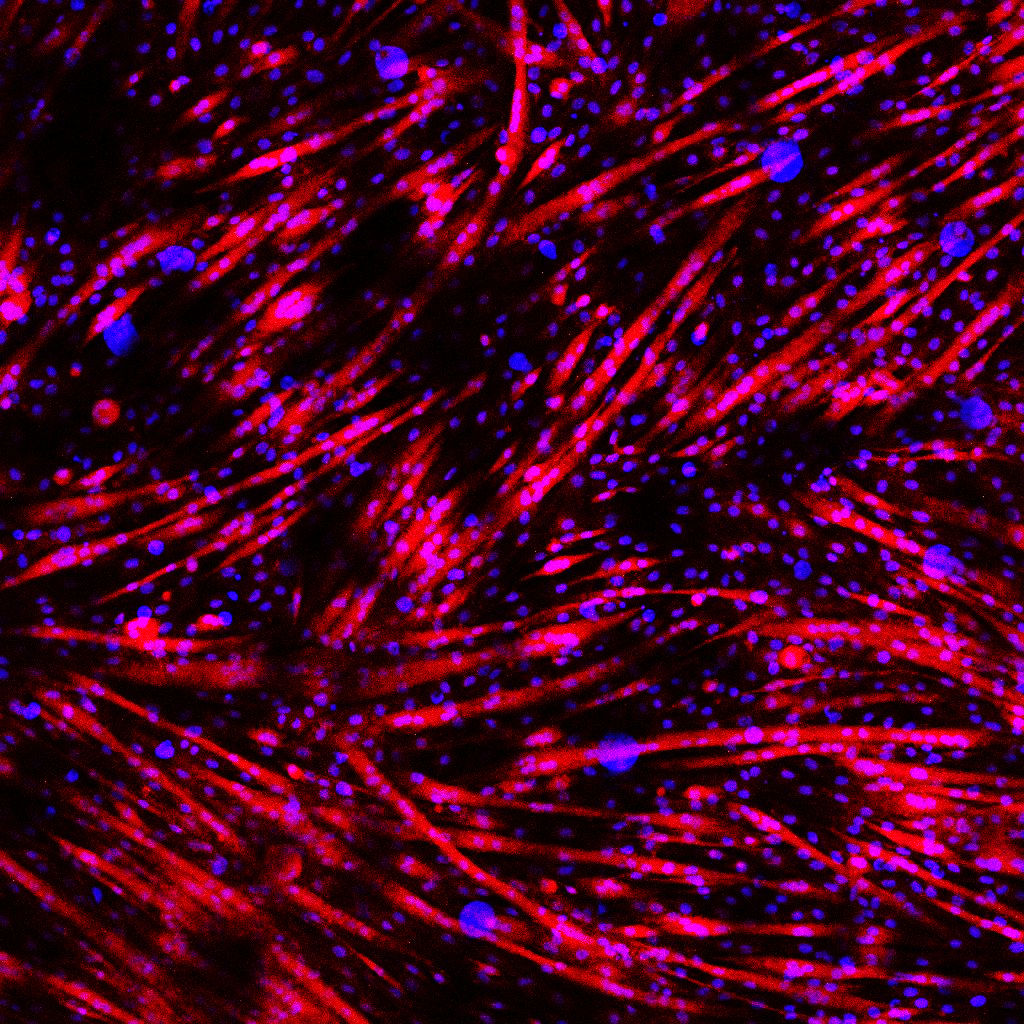 Densely packed, aligned human myotubes stained for myosin heavy chain in red with nuclei counterstained blue